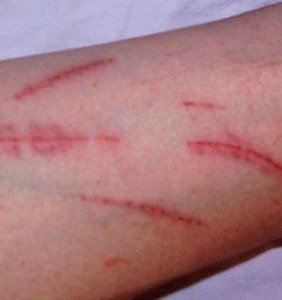 cutting